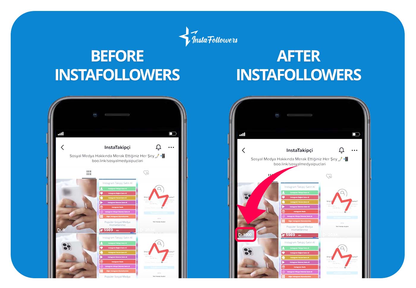 buy automatic TikTok views before & after